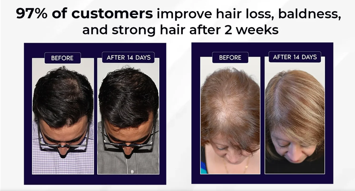 FEG Plus Hair Growth Spray