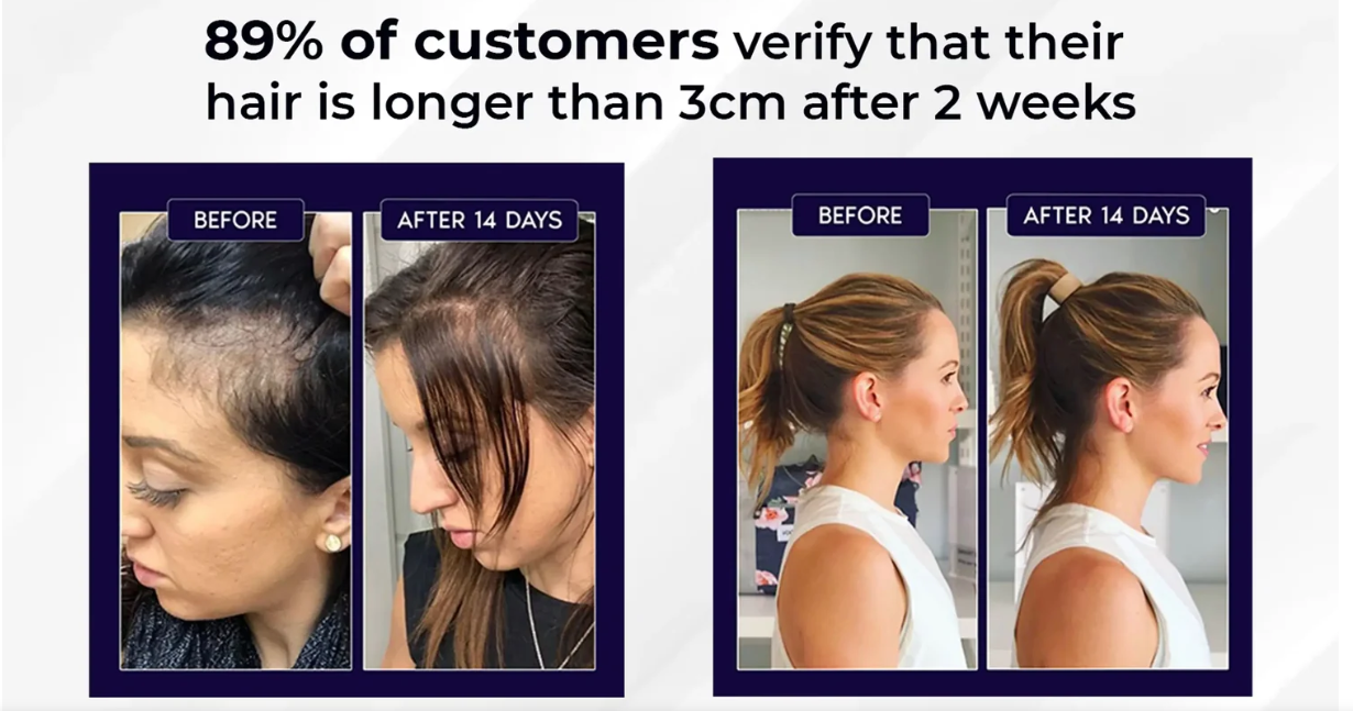 FEG Plus Hair Growth Spray