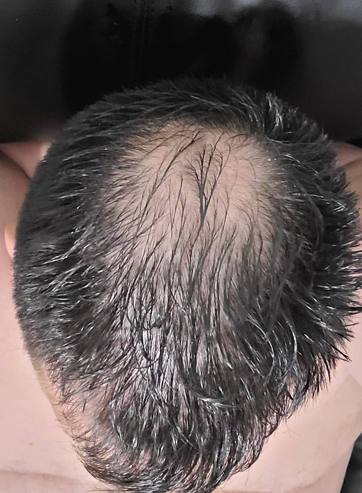 FEG Plus Hair Growth Spray